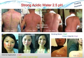 Strong Acidic Water 2.5 pH
1st Nov 2011 17th Nov 2011 21st Dec 2011 31st Dec 2011
Dec 11 Jan 12 Feb 12
Susan from Singapore
Dec 11 Feb 12External Application: 2.5pH
4.5pH, 5.0pH, 5.5pH & 6.0pH
Drinking Water: 7.0pH
8.5pH, 9.0pH & 9.5pH
Kota Kinabalu
From Malayasia
 