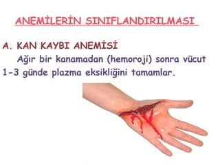 ANEMİLERİN SINIFLANDIRILMASI
A. KAN KAYBI ANEMİSİ
Ağır bir kanamadan (hemoroji) sonra vücut
1-3 günde plazma eksikliğini tamamlar.
 