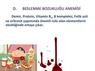 D. BESLENME BOZUKLUĞU ANEMİSİ
Demir, Protein, Vitamin B12, B kompleksi, Folik asit
ve eritrosit yapımında önemli rolü olan elementlerin
eksikliğinde ortaya çıkar.
 