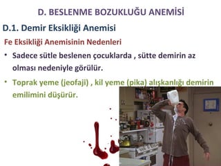 • Sadece sütle beslenen çocuklarda , sütte demirin az
olması nedeniyle görülür.
• Toprak yeme (jeofaji) , kil yeme (pika) alışkanlığı demirin
emilimini düşürür.
Fe Eksikliği Anemisinin Nedenleri
D. BESLENME BOZUKLUĞU ANEMİSİ
D.1. Demir Eksikliği Anemisi
 