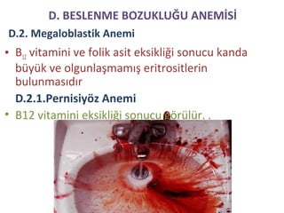 D.2. Megaloblastik Anemi
• B12 vitamini ve folik asit eksikliği sonucu kanda
büyük ve olgunlaşmamış eritrositlerin
bulunmasıdır
D.2.1.Pernisiyöz Anemi
• B12 vitamini eksikliği sonucu görülür. .
D. BESLENME BOZUKLUĞU ANEMİSİ
 