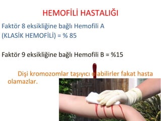 Faktör 8 eksikliğine bağlı Hemofili A
(KLASİK HEMOFİLİ) = % 85
Faktör 9 eksikliğine bağlı Hemofili B = %15
Dişi kromozomlar taşıyıcı olabilirler fakat hasta
olamazlar.
HEMOFİLİ HASTALIĞI
 