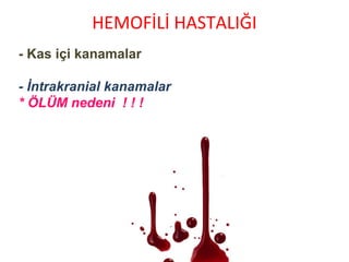 - Kas içi kanamalar
- İntrakranial kanamalar
* ÖLÜM nedeni ! ! !
HEMOFİLİ HASTALIĞI
 