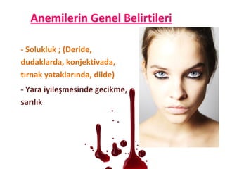 Anemilerin Genel Belirtileri
- Solukluk ; (Deride,
dudaklarda, konjektivada,
tırnak yataklarında, dilde)
- Yara iyileşmesinde gecikme,
sarılık
 