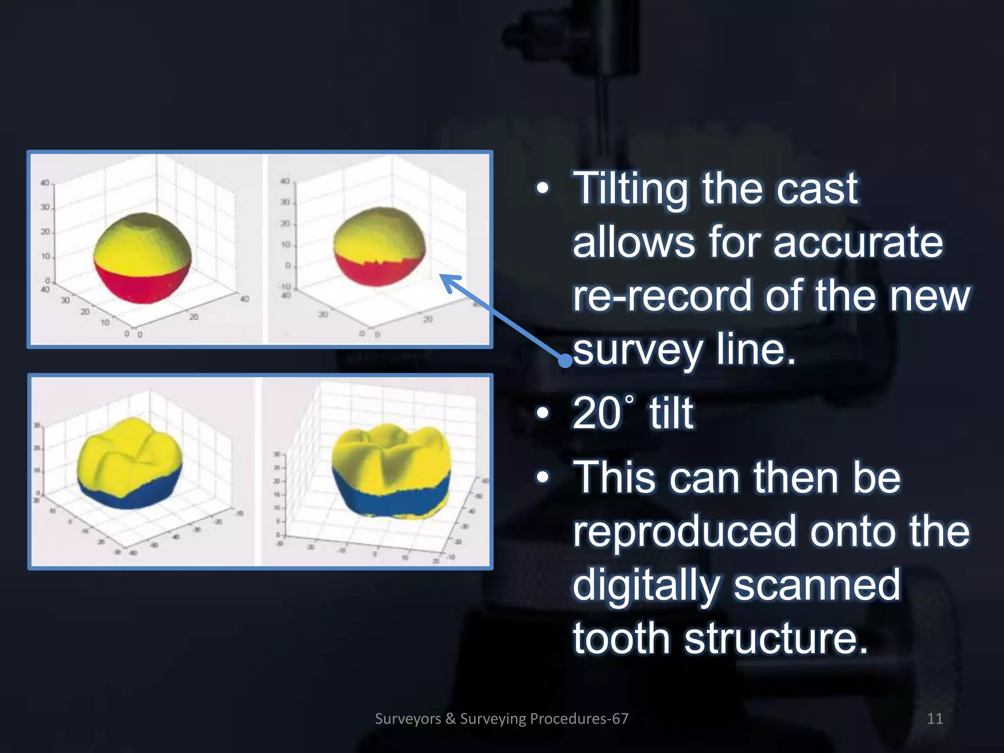SURVEYORS & SURVEYING PROCEDURES IN REMOVABLE PARTIAL PROSTHODONTICS | PPTX