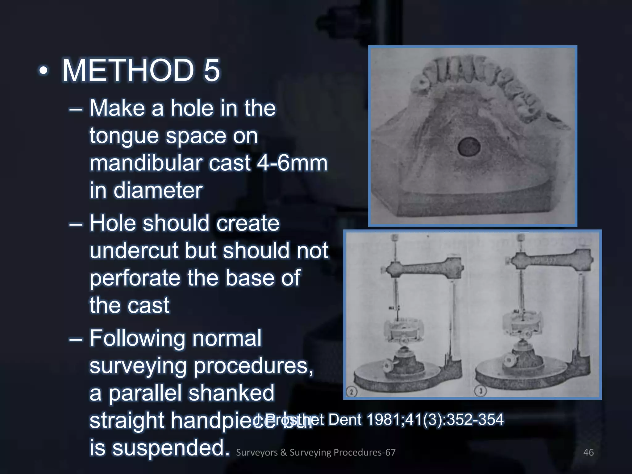 SURVEYORS & SURVEYING PROCEDURES IN REMOVABLE PARTIAL PROSTHODONTICS ...