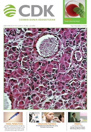 PRAKTIS 
Terapi Cairan dan Darah 
ISSN: 0125-913 X I 177 / vol.37 no. 4 / Mei - Juni 2010 http.//www.kalbe.co.id/cdk 
hasil penelitian 
Pengaruh Ekstrak Daun Singkong 
(Manihot uttilisima) terhadap Fungsi 
Hati dan Ginjal Tikus Putih yang 
Diinduksi Karsinogen Nitrosamin 
tinjauan pustaka 
Penatalaksanaan Mual Muntah yang 
Diinduksi Kemoterapi 
Profil 
Dr. Yow Pin, PHD, 
Setiap Penemuan Dapat 
Menolong Ribuan Pasien 
 