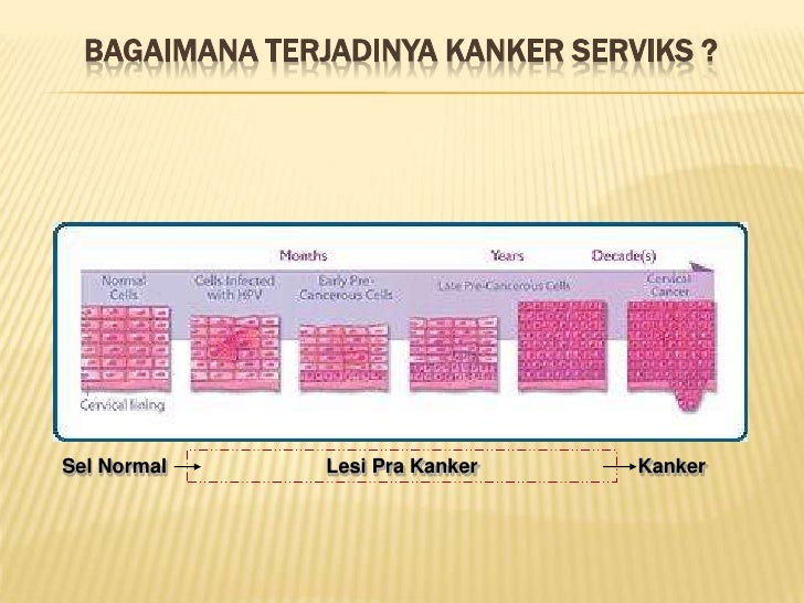 Kanker Serviks Gejala Penyebab Dan Mengobati