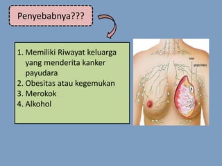 Penyebabnya???
1. Memiliki Riwayat keluarga
yang menderita kanker
payudara
2. Obesitas atau kegemukan
3. Merokok
4. Alkohol
