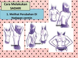 1. Melihat Perubahan Di
Hadapan cermin
Cara Melakukan
SADARI
TAHAP 1
TAHAP 2
TAHAP 3
TAHAP 4