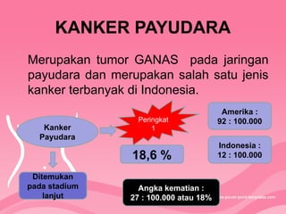 KANKER PAYUDARA
Merupakan tumor GANAS pada jaringan
payudara dan merupakan salah satu jenis
kanker terbanyak di Indonesia.
Kanker
Payudara
Peringkat
1
18,6 %
Indonesia :
12 : 100.000
Amerika :
92 : 100.000
Angka kematian :
27 : 100.000 atau 18%
Ditemukan
pada stadium
lanjut
 