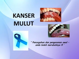 KANSER
MULUT
‘’ Pencegahan dan pengesanan awal –
anda boleh merubahnya !!! ’
 