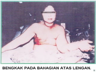 iiiiiiiiiiiiiiiiiiiiiiiiiii
10
 