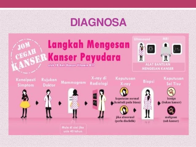 Gambar Kanser Payudara Kanser Payudara