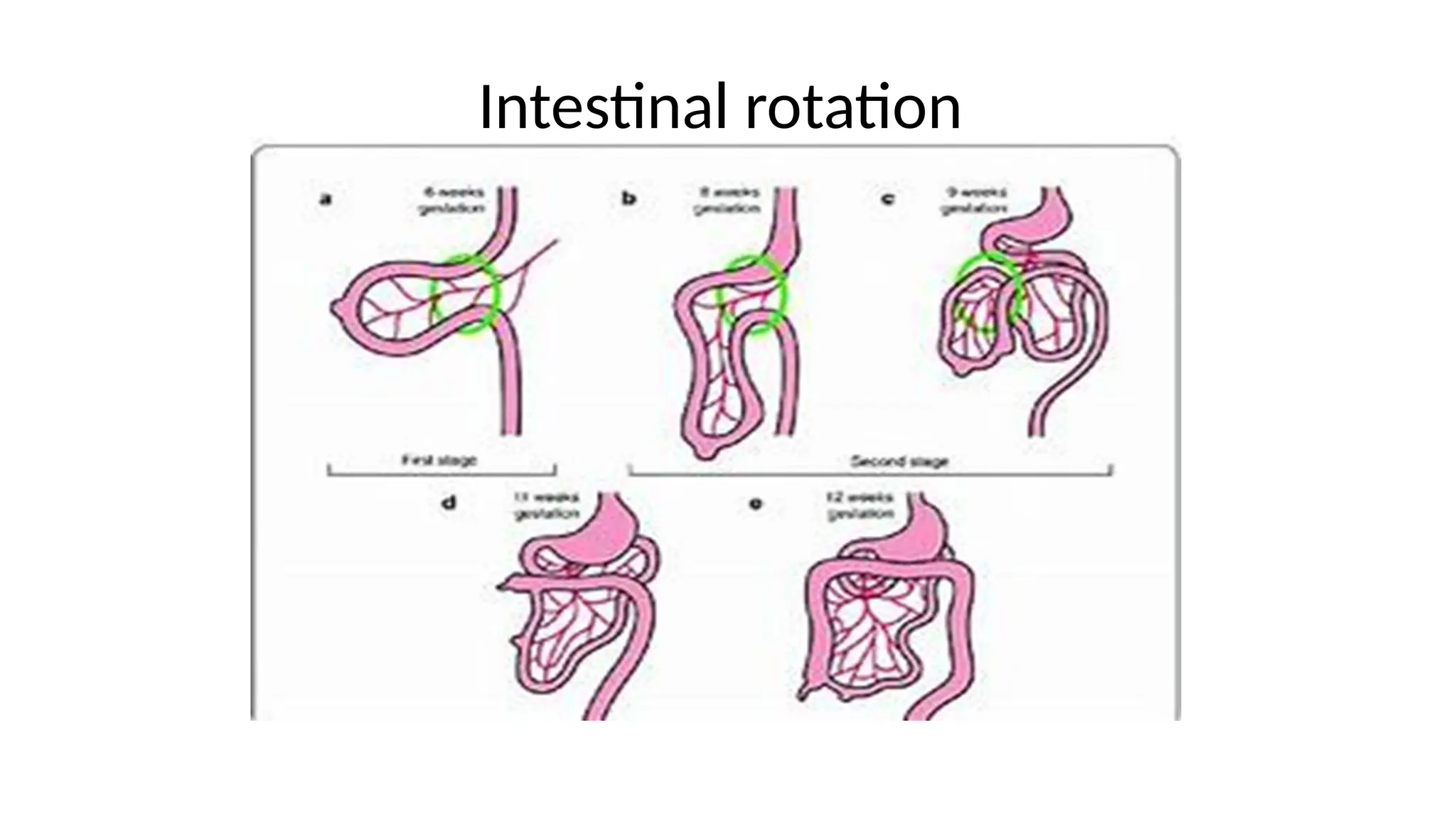 embryology of malformations with clinical references | PPTX