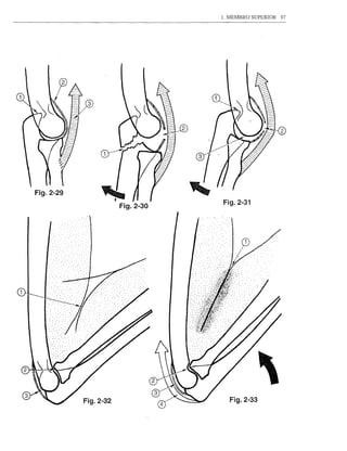 1. MEMBRO SUPERIOR   97




    Fig.2-29
                          Fig.2-31




1




               Fig.2-32     Fig.2-33
 