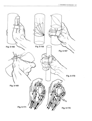 1. MEMBRO SUPERIOR   245




Fig.5-166               Fig.5-168




                                             Fig.5-170




    Fig.5-169




            Fig.5-171
                                        Fig.5-172
 