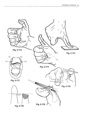1. MEMBRO SUPERIOR   247




                                           Fig.5-175



LU



                         Fig.5-174




     Fig.5-177


                                     Fig.5-176




                     Fig.5-178
         Fig.5-179
 