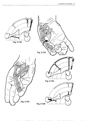 1. MEMBRO SUPERIOR   257




                 Fig.5-194




            .




                             Fig.5-196




Fig.5-197
 