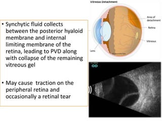 Age-related ocular anatomical and physiological || Kapil Gautam | PPTX