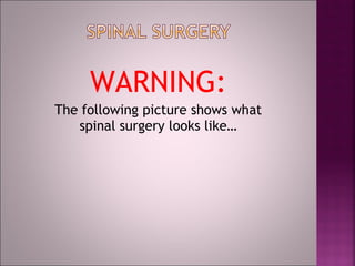 Lower Back Surgery Risks Avoid Lower Back Or Neck Surgery | PPT