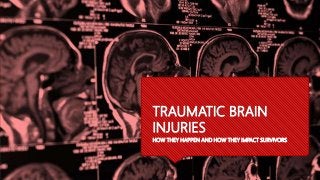 TRAUMATIC BRAIN
INJURIES
HOW THEY HAPPEN AND HOW THEY IMPACT SURVIVORS
 