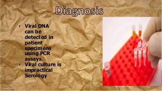• Viral DNA
can be
detected in
patient
specimens
using PCR
assays.
• Viral culture is
impractical
Serology
 