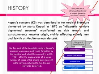 Moritz Kaposi was an
important Hungarian physician
and dermatologist, discoverer
of skin tumor that bears his
name (Kaposi's sarcoma).
HISTORY
Kaposi's sarcoma (KS) was described in the medical literature
pioneered by Moriz Kaposi in 1872 as "idiopathic multiple
pigmented sarcoma" manifested as skin tumors and
extracutaneous vascular origin, mainly affecting elderly men
and Jewish or Mediterranean descent.
But for most of the twentieth century, Kaposi's
sarcoma was a rare entity and forgotten by
the medical and scientific community, until in
1981, after the appearance of a large
number of cases of KS among gay men with
AIDS carriers, returned to the disease
relevance deserved.
Classical Form
Endemic Form (African)
Iatrogenic Form
Epidemic Form (associated
with AIDS).
Polar forms of
Kaposi's Sarcoma
 