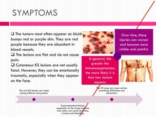 SYMPTOMS
 The tumors most often appear as bluish
bumps red or purple skin. They are red
purple because they are abundant in
blood vessels.
 The lesions are flat and do not cause
pain.
 Cutaneous KS lesions are not usually
fatal. However, they can be emotionally
traumatic, especially when they appear
on the face.
Over time, these
injuries can worsen
and become more
visible and painful.
In general, the
greater the
immunosuppression,
the more likely it is
that new lesions
appear.
The oral KS lesions can make
eating difficult and painful.
Gastrointestinal lesions,
especially of the large intestine
and colon, can cause diarrhea,
cramps and bleeding.
The KS Lung can cause serious
breathing difficulties and
discomfort.
 