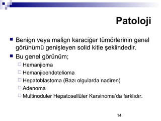 14
 Benign veya malign karaciğer tümörlerinin genel
görünümü genişleyen solid kitle şeklindedir.
 Bu genel görünüm;
 Hemanjioma
 Hemanjioendotelioma
 Hepatoblastoma (Bazı olgularda nadiren)
 Adenoma
 Multinoduler Hepatosellüler Karsinoma’da farklıdır.
Patoloji
 