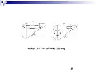 21
Pretext –IV: Dört sektörde tutulmuş
 