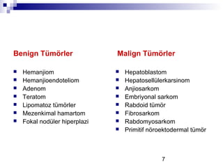 7
Benign Tümörler
 Hemanjiom
 Hemanjioendoteliom
 Adenom
 Teratom
 Lipomatoz tümörler
 Mezenkimal hamartom
 Fokal nodüler hiperplazi
Malign Tümörler
 Hepatoblastom
 Hepatosellülerkarsinom
 Anjiosarkom
 Embriyonal sarkom
 Rabdoid tümör
 Fibrosarkom
 Rabdomyosarkom
 Primitif nöroektodermal tümör
 