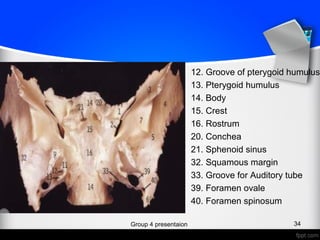 12. Groove of pterygoid humulus
13. Pterygoid humulus
14. Body
15. Crest
16. Rostrum
20. Conchea
21. Sphenoid sinus
32. Squamous margin
33. Groove for Auditory tube
39. Foramen ovale
40. Foramen spinosum
Group 4 presentaion 34
 