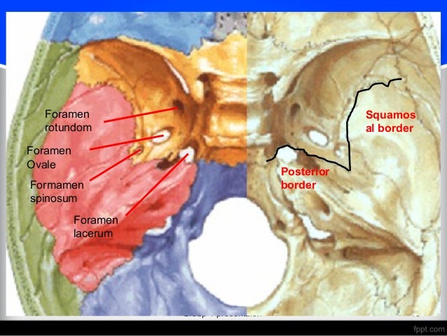 sphenoid bone