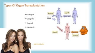 Isograft Examples HUMAN ORGAN TRANSPLANTATION AND ITS ACT | PPTX