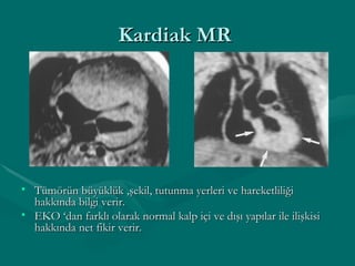 Kardiak MR  Tümörün büyüklük ,şekil, tutunma yerleri ve hareketliliği hakkında bilgi verir. EKO ‘dan farklı olarak normal kalp içi ve dışı yapılar ile ilişkisi hakkında net fikir verir. 