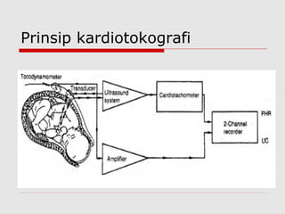 Prinsip kardiotokografi
 