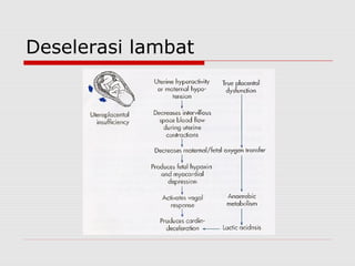 Deselerasi lambat
 
