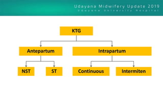 KTG
IntrapartumAntepartum
NST ST Continuous Intermiten
 
