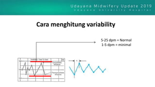 5-25 dpm = Normal
1-5 dpm = minimal
Cara menghitung variability
 