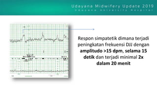 Respon simpatetik dimana terjadi
peningkatan frekuensi DJJ dengan
amplitudo >15 dpm, selama 15
detik dan terjadi minimal 2x
dalam 20 menit
 