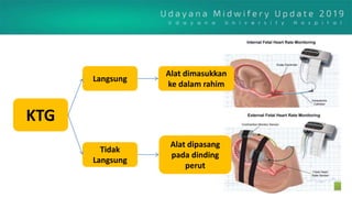 KTG
Langsung
Tidak
Langsung
Alat dimasukkan
ke dalam rahim
Alat dipasang
pada dinding
perut
 