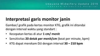Gambar/ grafik pada kertas monitor KTG, grafik ini ditandai
dengan interval waktu yang standart :
• Kecepatan kertas di atur 1 cm/ menit
• Sensitivitas 20 detak per menit/cm (beat per minute, bpm)
• KTG dapat merekam DJJ dengan interval 30 – 210 bpm
Interpretasi garis monitor janin
 