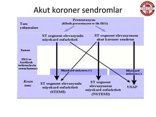 Akut koroner sendromlar
 