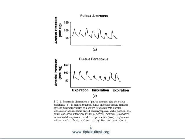 Kardiyolojide fizik bulgular(fazlası için