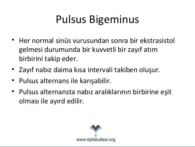 Pulsus bigeminus Pulsus bigeminus