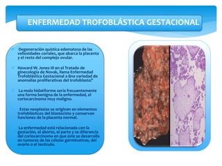  Degeneración quística edematosa de las
vellosidades coriales, que abarca la placenta
y el resto del complejo ovular.
 Howard W. Jones III en el Tratado de
ginecología de Novak, llama Enfermedad
Trofoblástica Gestacional a “una variedad de
anomalías proliferativas del trofoblasto”.
 La mola hidatiforme sería frecuentemente
una forma benigna de la enfermedad, el
coriocarcinoma muy maligno.
 Estas neoplasias se originan en elementos
trofoblásticos del blastocisto y conservan
funciones de la placenta normal.
 La enfermedad está relacionada con la
gestación, el aborto, el parto y se diferencia
del coriocarcinoma en que este se desarrolla
en tumores de las células germinativas, del
ovario o el testículo.
ENFERMEDAD TROFOBLÁSTICA GESTACIONAL
 