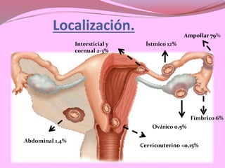 Abdominal 1,4%
Cervicouterino <0,15%
Ovárico 0,5%
Fímbrico 6%
Ampollar 79%
Ístmico 12%Intersticial y
cornual 2-3%
Localización.
 