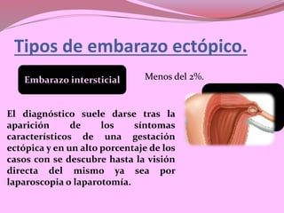Tipos de embarazo ectópico.
Embarazo intersticial Menos del 2%.
El diagnóstico suele darse tras la
aparición de los síntomas
característicos de una gestación
ectópica y en un alto porcentaje de los
casos con se descubre hasta la visión
directa del mismo ya sea por
laparoscopia o laparotomía.
 