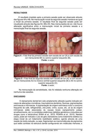 Revista UNINGÁ ISSN 2318-0579
Rev. UNINGÁ, Maringá, v. 56, n. S7, p. 35-42, out./dez. 2019 39
RESULTADOS
O resultado imediato após a primeira sessão pode ser observado através
das figuras 4A e 4B. Na mensuração inicial da segunda sessão manteve-se igual
a inicial da primeira sessão. O resultado final da segunda sessão pode ser
visualizado através das figuras 5A, 5B e 5C. Nas mensurações de cor, não houve
alteração significativa entre a mensuração inicial da primeira sessão e a
mensuração final da segunda sessão.
Figura 4 – Foto final da primeira sessão sem escala de cor (A) e com escala de
cor mensurando B4 no canino superior esquerdo (B).
Fonte: o autor.
Figura 5 – Foto final da segunda sessão sem escala de cor (A), e com escala
de cor mensurando A3 no incisivo central superior esquerdo (B) e A4 no canino
superior esquerdo (C).
Fonte: o autor.
Na mensuração da sensibilidade, não foi relatada nenhuma alteração em
nenhuma das sessões.
DISCUSSÃO
O clareamento dental tem sido amplamente utilizado quanto indicado em
casos de alterações cromáticas, traumatismos dentários, fluorose, pigmentações
extrínsecas e intrínsecas. A pigmentação de origem extrínseca inclui o consumo
frequente de café, refrigerantes, chá preto, vinho, sucos, etc. Já as de origem
intrínsecas estão associadas às causas locais (sangramento pulpar,
envelhecimento, etc.) e condições sistêmicas (defeitos genéticos e induzidos por
drogas como a tetraciclina) (KINA et al., 2015; PENHA et al., 2015). Nesses
casos, pode ser indicado o uso de géis clareadores como tratamento estético ou
etapa inicial de um tratamento reabilitador estético, agindo através de uma
reação de óxido-redução, ou seja, fragmentam as macromoléculas de pigmentos
que estão contidas na estrutura dental configurando em moléculas menores, e
 